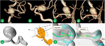 A Novel Scoring System for Rupture Risk Stratification of Intracranial Aneurysms: A Hemodynamic and Morphological Study